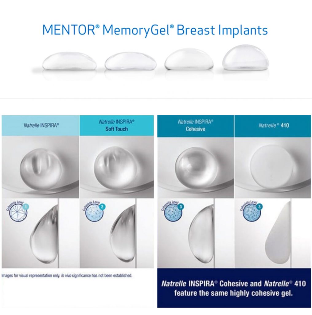 Varrying Breast Implants