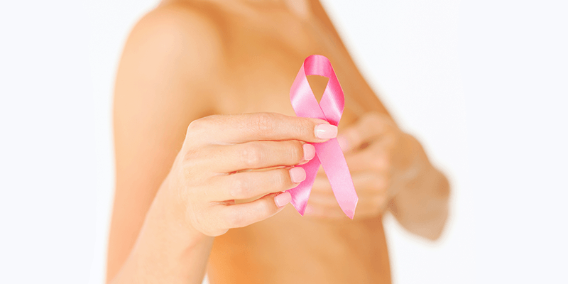 Burke-Breast-Cancer